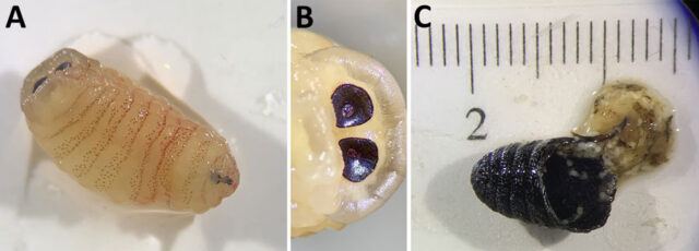 Woman sneezes out maggots after fly larvae became lodged in her deviated septum